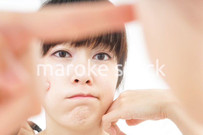 肌荒れをケアする若い女性