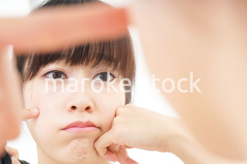 肌荒れをケアする若い女性