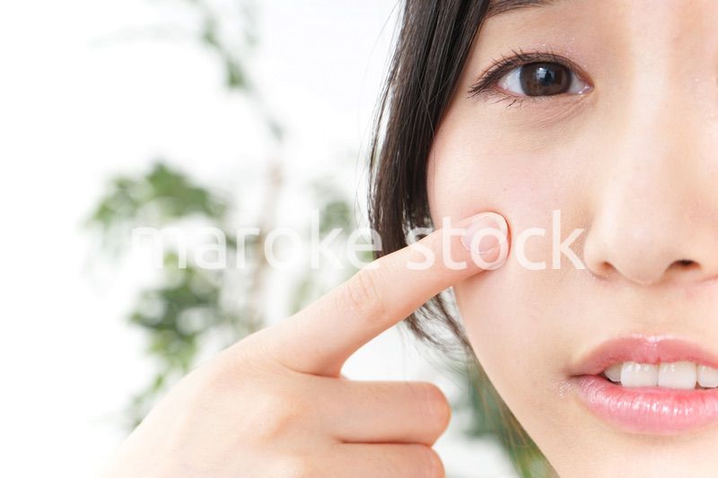 ニキビ・肌荒れ