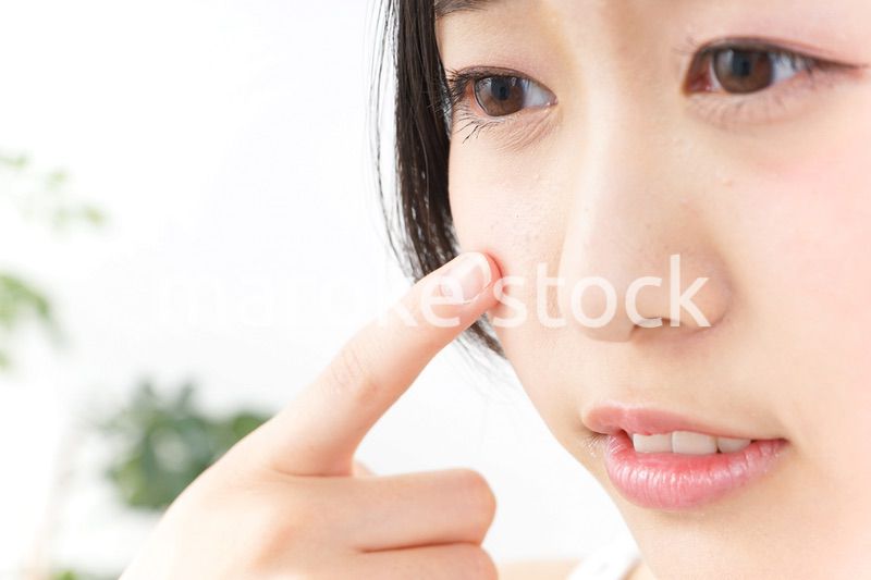 ニキビ・肌荒れ