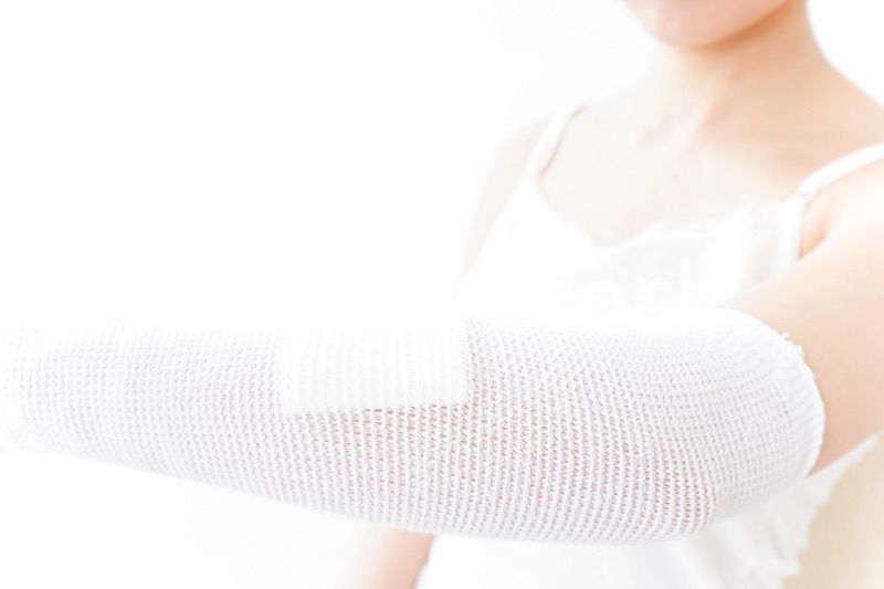 腕のケガをした女性