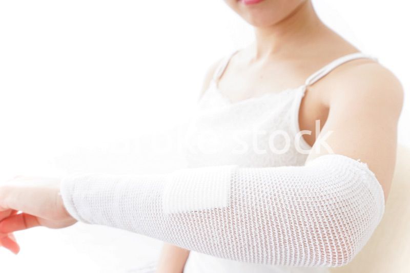 腕のケガをした女性