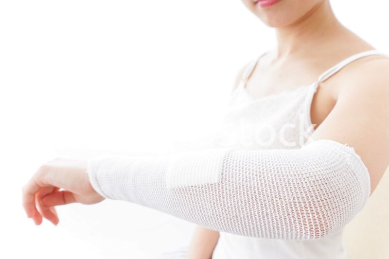 腕のケガをした女性
