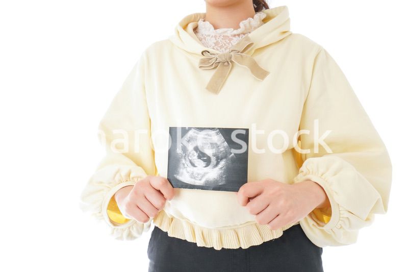 エコー画像を持つ若い妊婦の女性