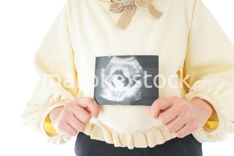 エコー画像を持つ若い妊婦の女性
