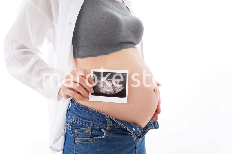 エコー画像を持つ若い妊婦