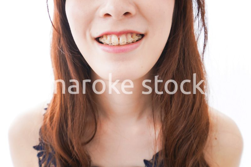 歯列矯正をする若い女性