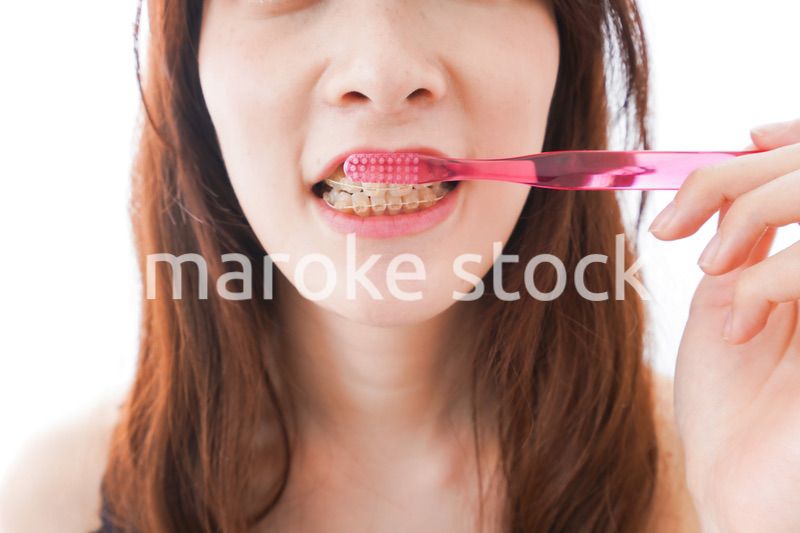 歯列矯正をする若い女性