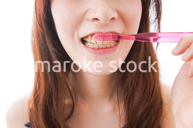 歯列矯正をする若い女性