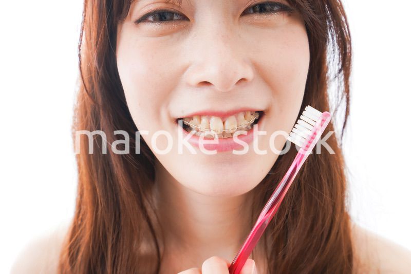 歯列矯正をする若い女性