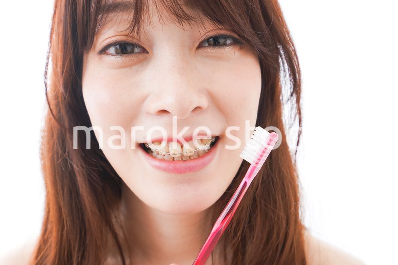歯列矯正をする若い女性