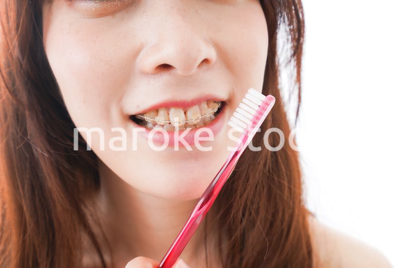 歯列矯正をする若い女性