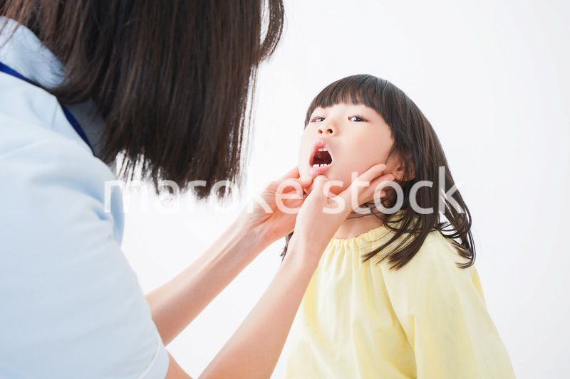 歯医者さんに治療をしてもらう小さな女の子